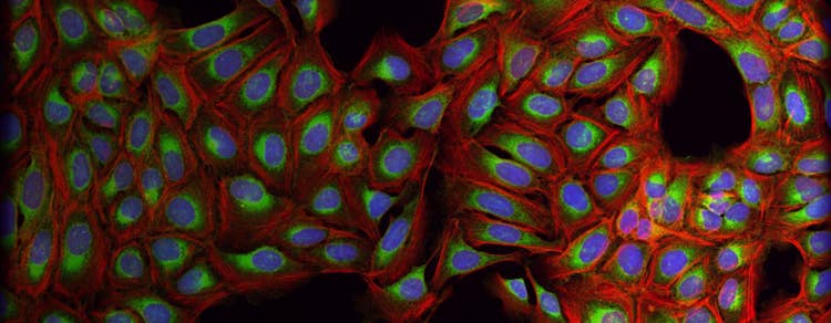 Cell Painting