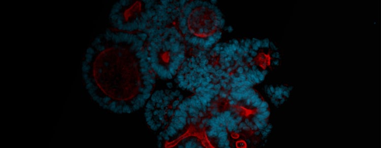 Blue Red Organoid