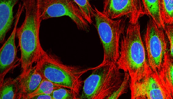 Simplified workflow for phenotypic profiling based on the Cell Painting assay