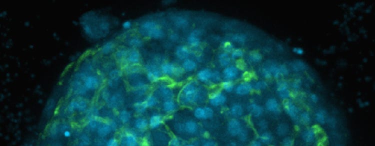 Liver Toxicity Effects