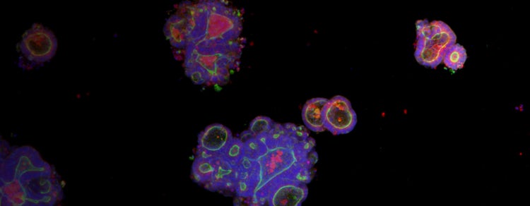 Mastering 3D cell culture