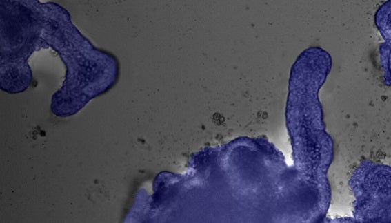 AI enabled phenotypic analysis of label-free intestinal organoids