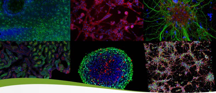 ISSCR 2021 Innovation Showcase