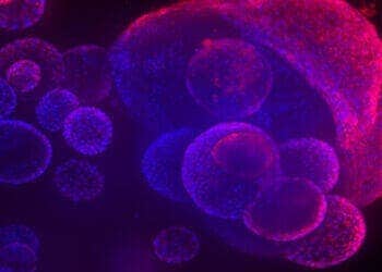Organoids