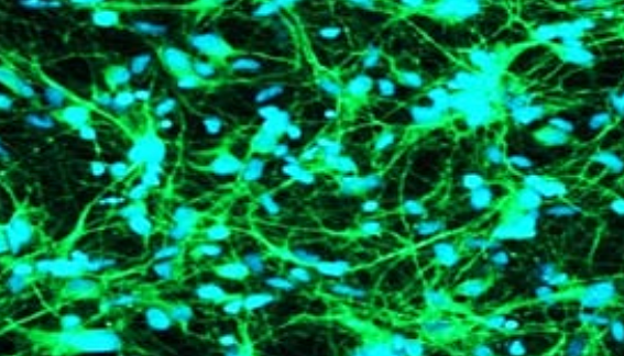 Identify compound-specific effects on neurite outgrowth using ImageXpress Pico system