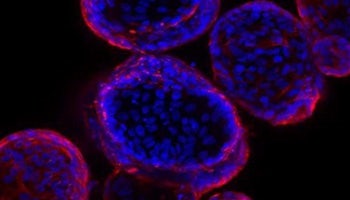 Organoid
