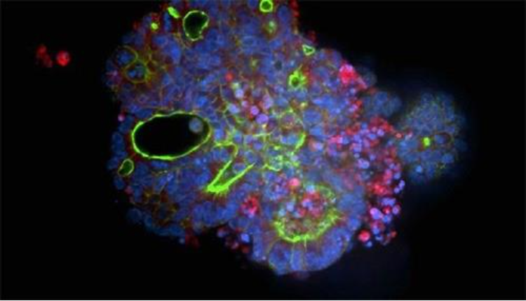 CRC organoid sample imaged with the ImageXpress® HCS.ai system