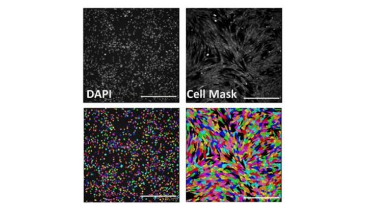 Images from senescence models through IN Carta Image Analysis Software