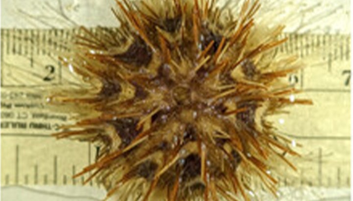 Pic of Sea urchin embryos in IN Carta Image Analysis Software