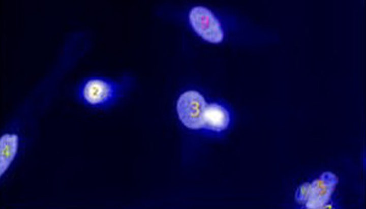 Phenoglyph module