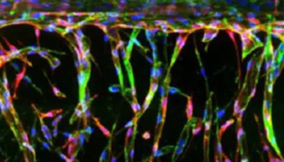 Organ-on-a-Chip