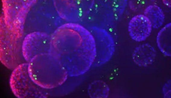 Organoid