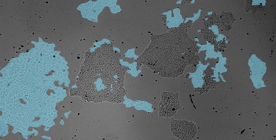 Automated cell culture