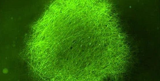 Culturing brain organoids