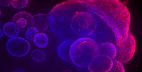 Toxicity Screening