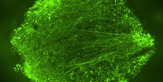 Calcium (Ca2+) Imaging