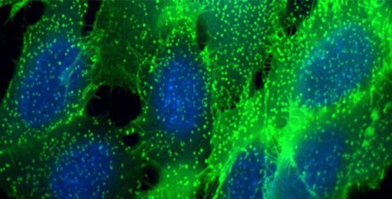 TRF, TR-FRET & HTRF