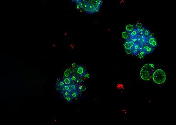 3D Ready Organoid Expansion