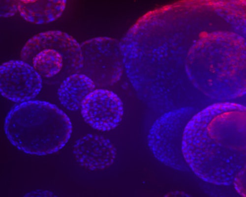 3D Organoids