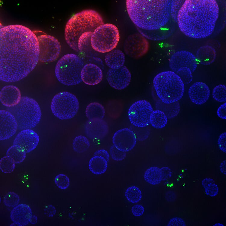 organoid image from ImageXpress Confocal HT.ai using In Carta