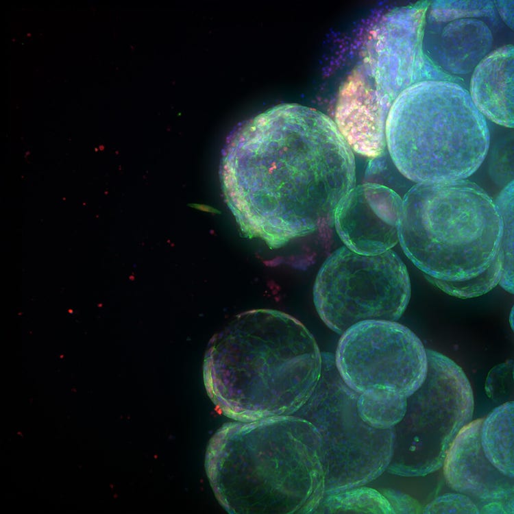 Organoid image from ImageXpress Confocal HT.ai using In Carta