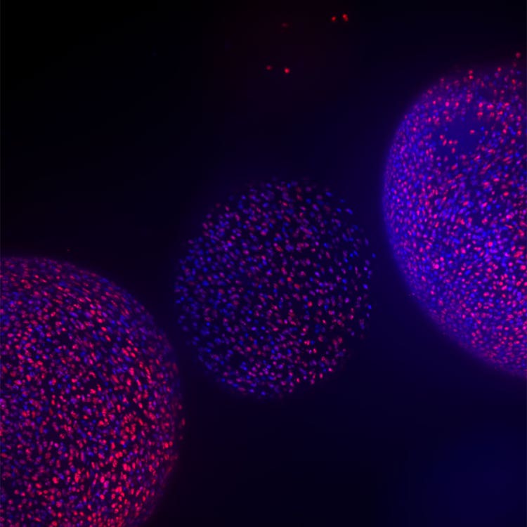 organoid image from ImageXpress Confocal HT.ai using In Carta