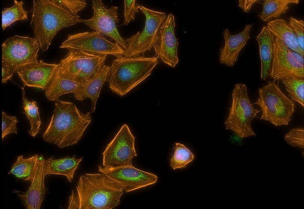 4-63x Translocation DIGI Con 3 Colors