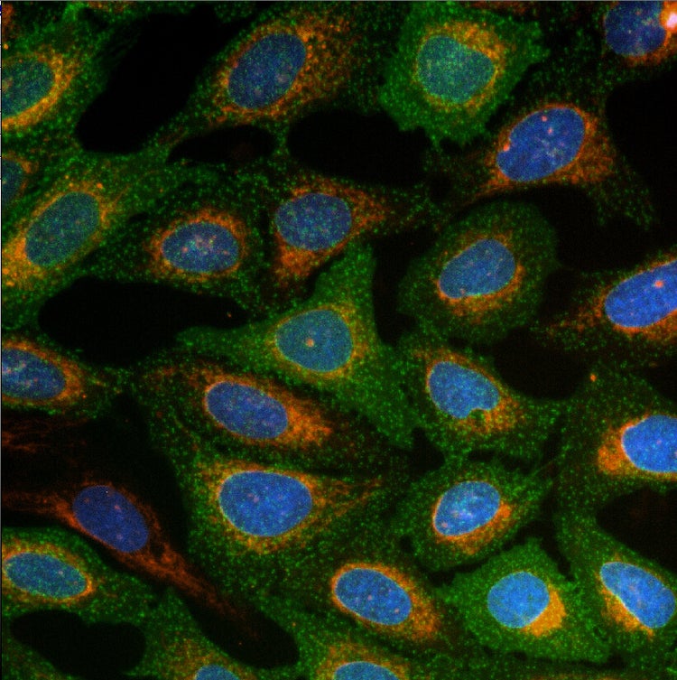 AgileOptix Technology for ImageXpress Micro Confocal