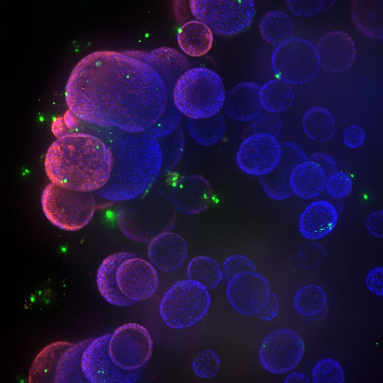 organoid image from ImageXpress Confocal HT.ai using In Carta