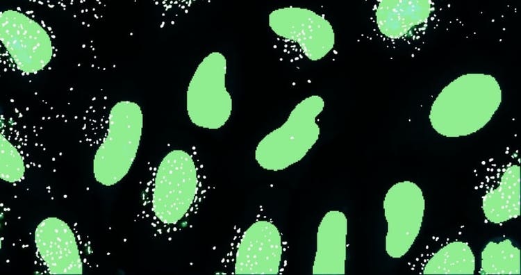 Vesicles C16 Analysis