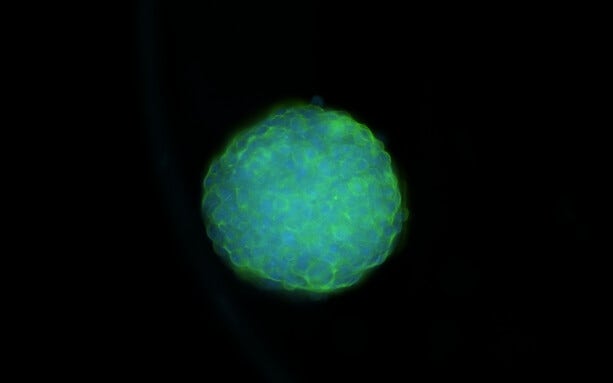 Spheroids 2 Colors Hoechst Phalloidin Digi Con