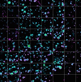 New Preclinical Testing Tools Help Researchers Tailor Treatment but Can They Fully Replace Mice?