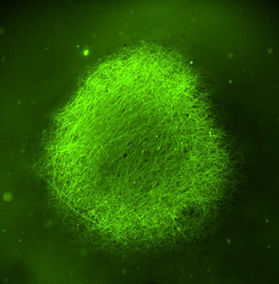 Organoids Promise to Accelerate Parkinson's and Alzheimer’s Research and Drug Discovery