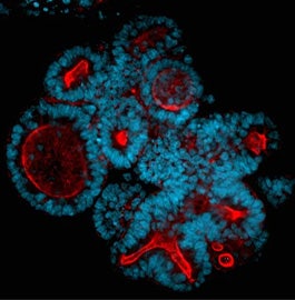 3D Organoids vs 2D Cell Lines in Drug Discovery and Disease Modeling