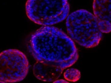 Organoids