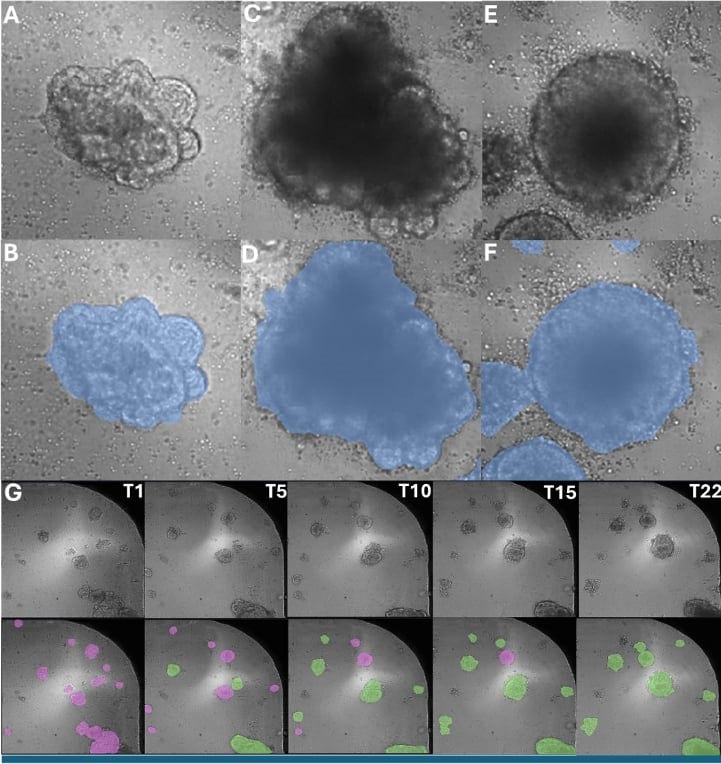 Representative TL image and B. the corresponding segmentation of intact organoids