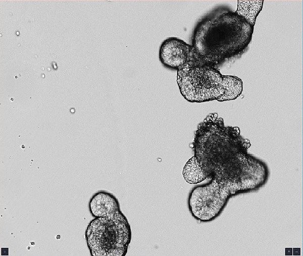 Intestinal Organoids image