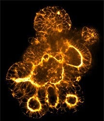 Actin filaments in colorectal cancer PDO stained with phalloidin