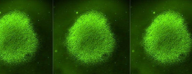 Organoids Accelerate Parkinson’s and Alzheimer’s Research & Drug Discovery