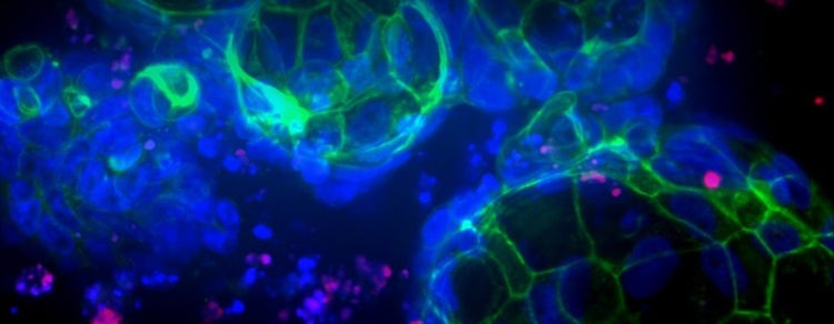 Organoids in Disease Research