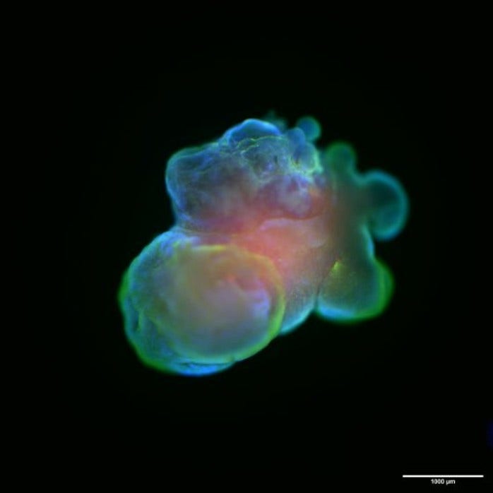 Brain organoids replicate the structural and functional complexity of human brain tissue