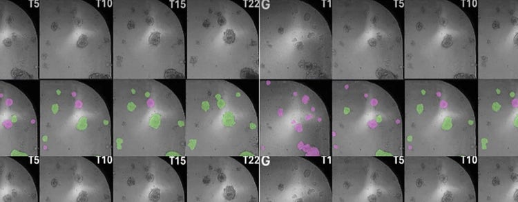 Cancer Immune Evasion and Immunotherapy