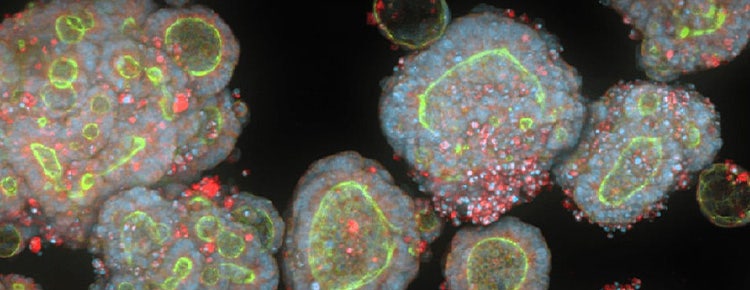 3D Organoids vs 2D Cell Lines in Drug Discovery & Disease Modeling