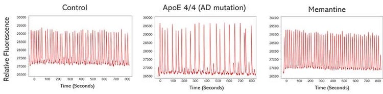Calcium oscillations