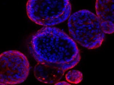 Organoids