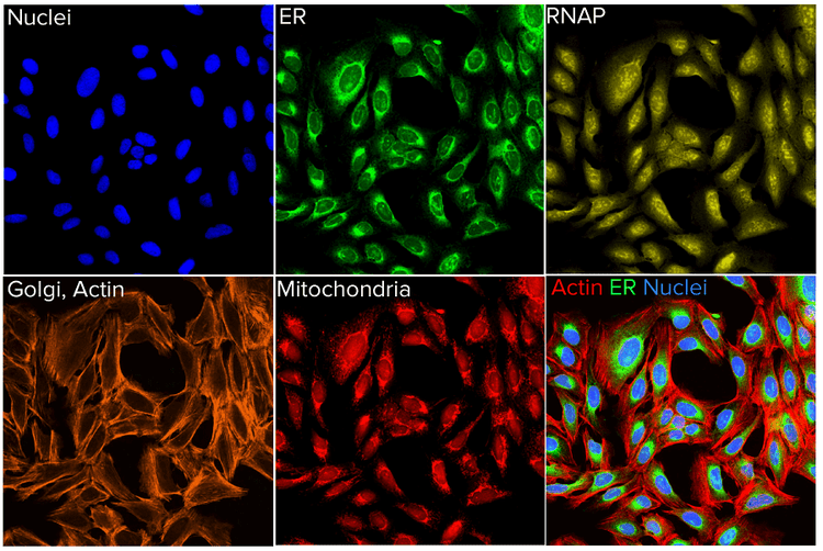 Representative image of the cell