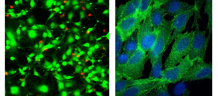 HeLa cells treated with straurosporine for 18 hours