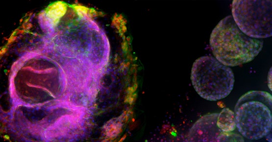 Pulmonary (lung) organoids