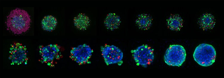 Spheroids grown in Corning Elplasia micro-cavity plates