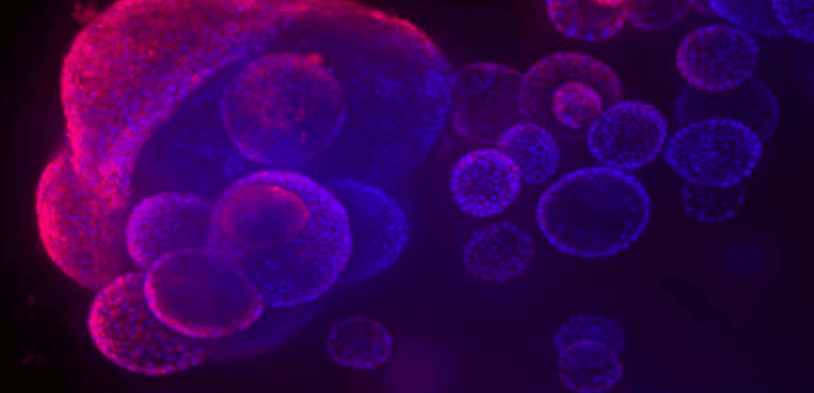 Cardiac Organoids